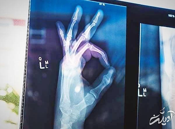 وضعیت استخوان در باغبانی 